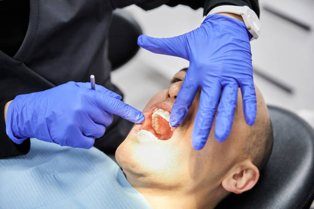 Best Broken or Cracked Tooth Emergency Dentist in Deer Park, TX